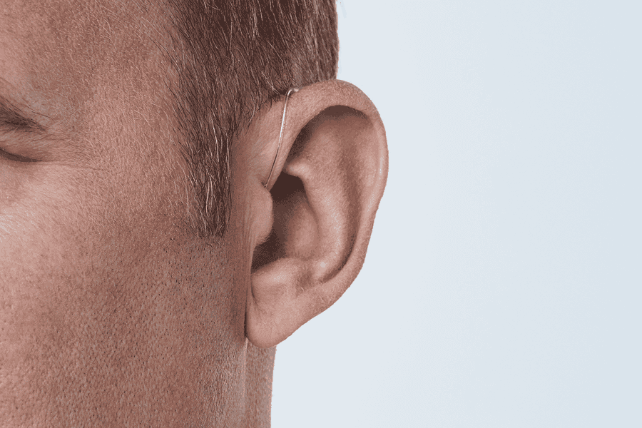 Oticon More™ miniRITE T - Image 7