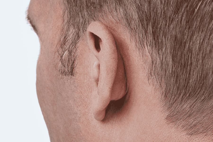 Oticon Own™ Invisible-in-the-Canal - Image 5