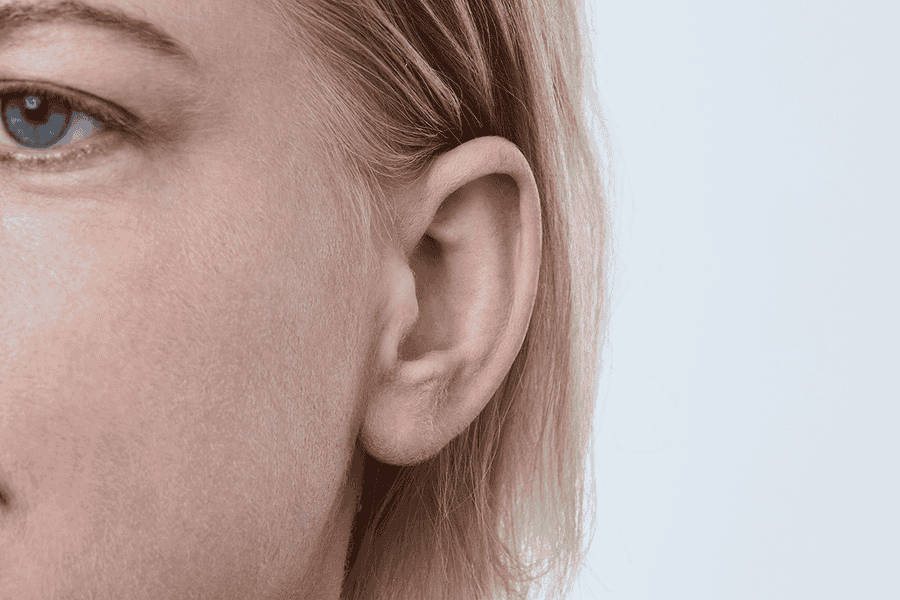 Oticon Siya In-the-Canal - Image 3